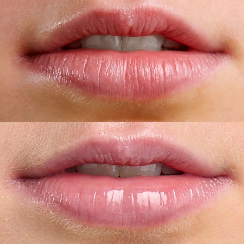Lip Spa Overnight Lip Mask