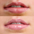 Lip Spa Lip Serum